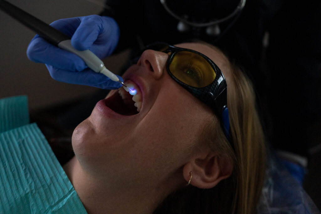 Cosmetic Dentistry 6 Gum Recontouring
