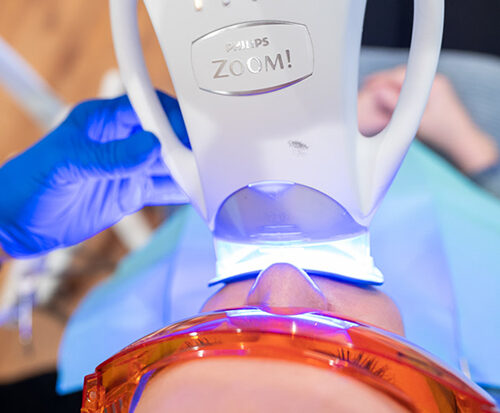 Cosmetic Dentistry 1 Professional Teeth Whitening Services | Cosmetic Dentistry