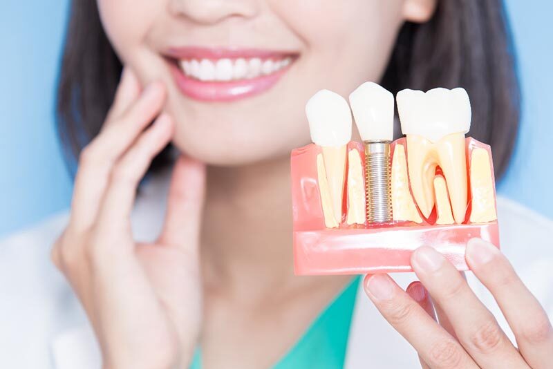 Restorative Dentistry 1 Implant Therapy | Restorative Dentistry